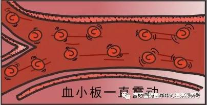 血小板是正常值的三倍？專家提醒小心血栓和出血！