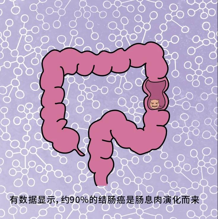 奪走“黑豹”生命的結腸癌，到底什么來頭？