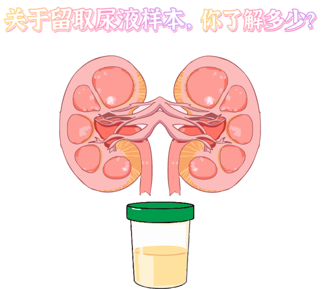 做尿檢，不得不說的注意事項(xiàng)！