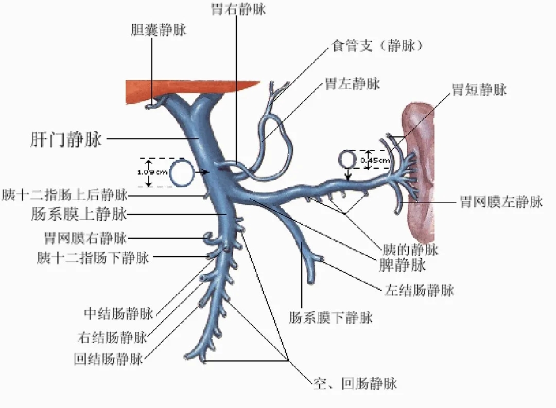 反復嘔血、黑便怎么辦？TIPS手術(shù)能解決