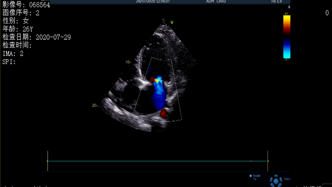 心電圖異常，心臟卻沒(méi)事，罪魁禍?zhǔn)资恰?>
				             </a>
                <div   id=