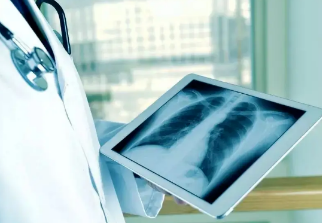 健康呼吸④體檢發(fā)現(xiàn)肺結(jié)節(jié)，我該怎么辦？