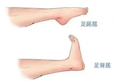 扭胯小連步、動(dòng)感搖花手……“科目三”雖火，運(yùn)動(dòng)損傷也要防！