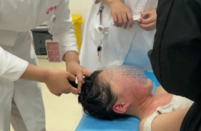 14歲，面、頸、胸燙傷，只因中午那鍋面湯…